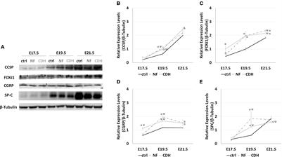 Distinct Epithelial Cell Profiles in Normal Versus Induced-Congenital Diaphragmatic Hernia Fetal Lungs